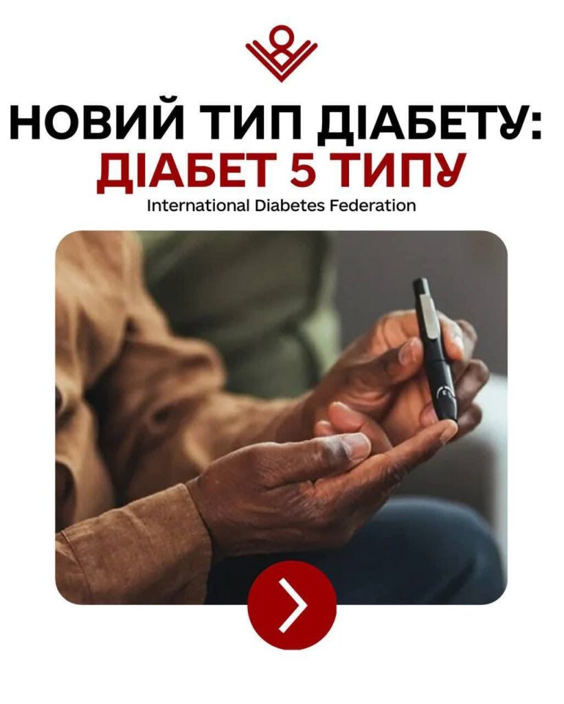Безглютенова та безмолочна дієта може призвести до розвитку діабету